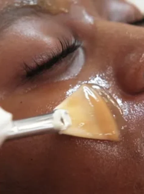 Skin Assessments & Consultation